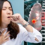 Sigara içmiyorum demek yetmiyor! Akciğer kanseri için pasif içici olmak yeterli