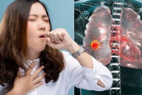 Sigara içmiyorum demek yetmiyor! Akciğer kanseri için pasif içici olmak yeterli