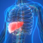 Karaciğer Yağlanması Neden Olur Ve Nasıl Geçer? Karaciğer Yağlanması Belirtileri ve Tedavisi