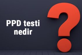 Ppd testi nedir, nasıl ve neden yapılır? PPD testi ne için yapılır?