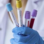 TTB duyurdu: Başhekim koronavirüs nedeniyle hayatını kaybetti