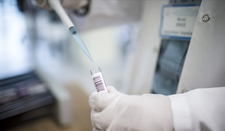 Maymun Çiçeği Virüsünde Yeni Varyant Tehlikesi!