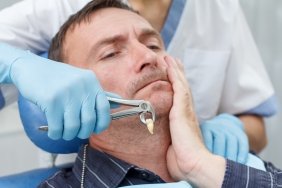 Dentist has extracted a sick tooth from patient in dental office