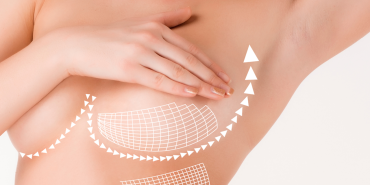 Meme Büyütme Ameliyatı Neden Tercih Edilir?