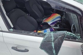 Evine baltalı saldırı düzenlenen kadın için adalet çağrısı yaptı: Bir